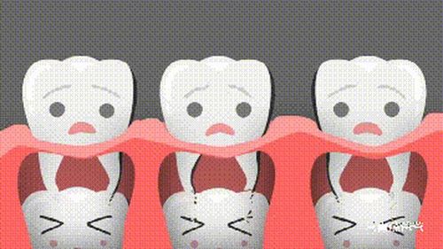双排牙齿要拔掉吗?如何预防