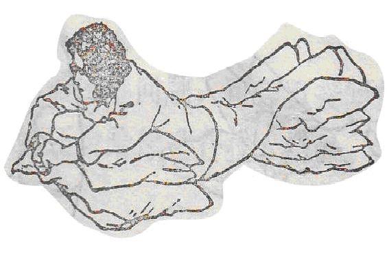 我是一个腰椎间盘突出患者,椎盘压迫神经使左腿疼痛不止?