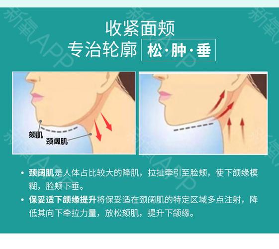 30单位 ,【40单位】botox下颌缘提升/颏肌放松2选1;多层次定点注射