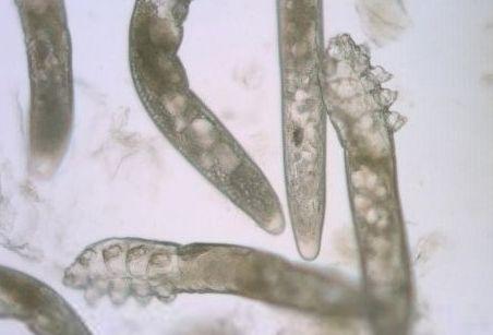 毛囊虫 毛囊虫是人体皮肤感染的一种最普遍的寄生虫病,医学上称为蠕