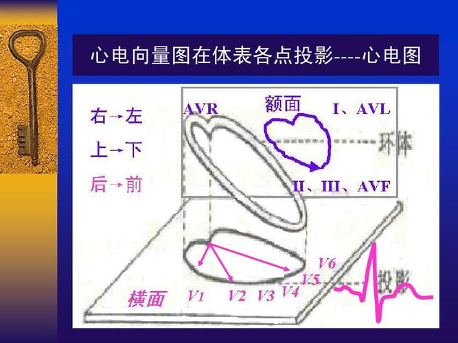 心电向量图在体表各点投影----心电图
