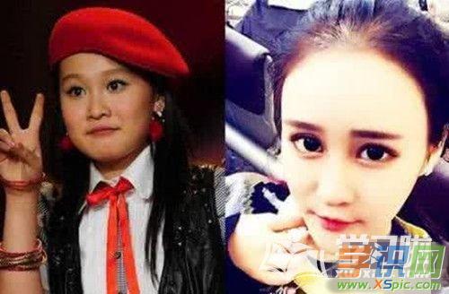 由于她现在和以前的照片相差太大,很多网友质疑她整容