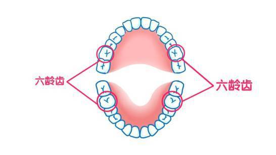 儿童窝沟封闭是针对牙齿发育时候的儿童进行的一种能有效增强牙齿抗龋