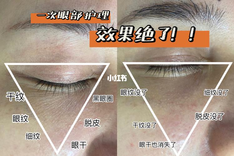 眼纹没了75干纹没了75细纹也没了75轻松逆袭