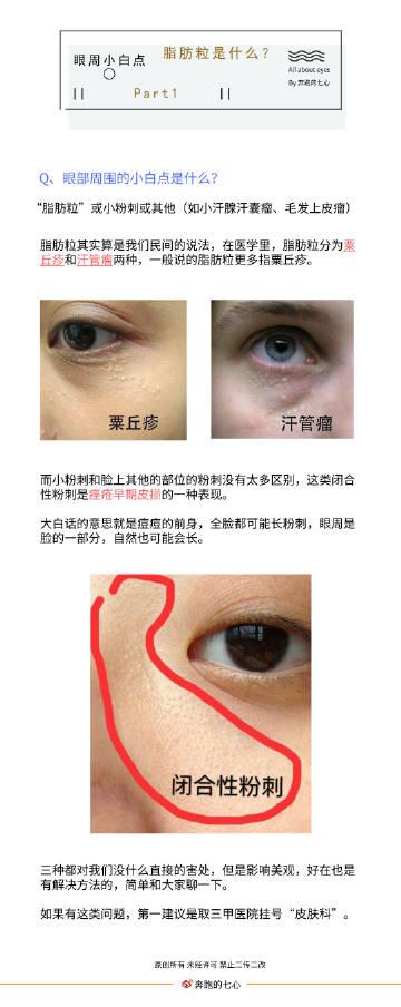奔跑的七心:       眼周问题:脂肪粒,粟丘疹,汗管瘤,粉刺