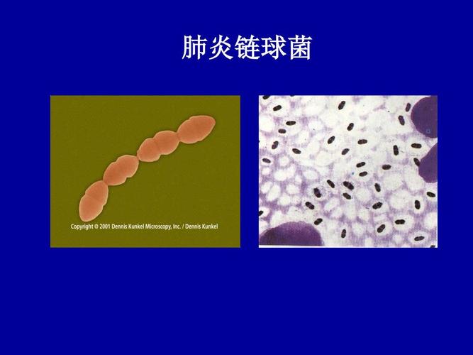 发   现丹毒streptococcus(90个种)链球菌的形态 链球菌属 肺炎链球菌