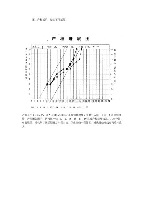 产程进展图.doc