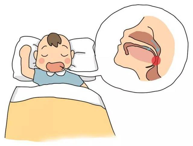 家长注意:孩子张嘴睡觉 ,打呼……真的是睡得香吗?