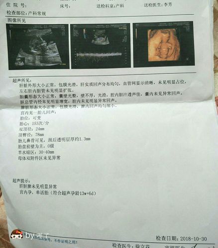 孕13周今天做了nt,发老公看说有点像男孩,他是喜欢女儿所以无所谓的