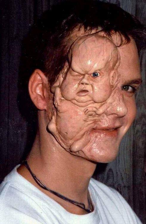 附:十世高僧悟达法师患人面疮记事