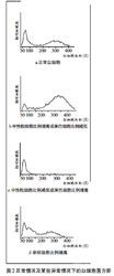 正常及异常白细胞直方图