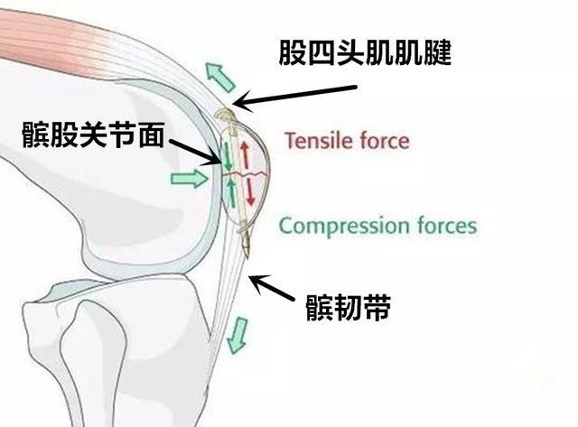 辟谣切除髌骨后就不能走路了吗看医生怎么说