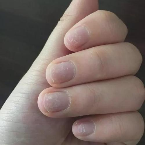 为什么你的顾客喜欢用手去抠指甲你知道手抠美甲的严重性吗