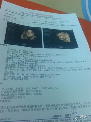 帮望看看四维结果求医生帮我看看
