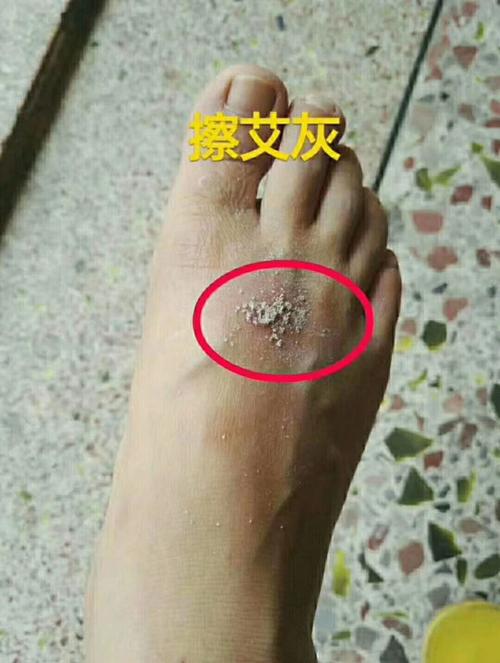 如何处理?