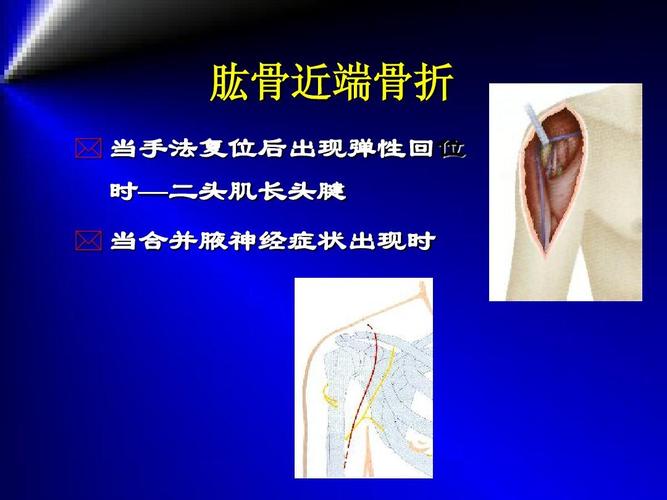 当手法复位后出现弹性回位 时—二头肌长头腱   当合并腋神经症状