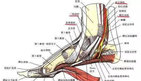 跟腱疼?令刘翔退役的跟腱末端病,究竟怎么康复?