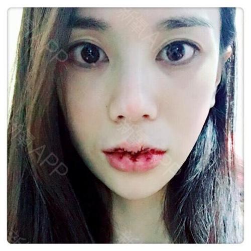 【唇综合案例分享】