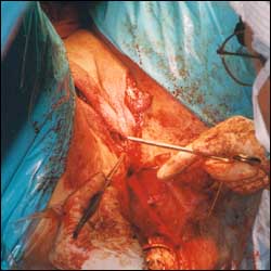 (社会新闻)变性大学生(附手术全过程) - 水之恋 - 水之恋 博客