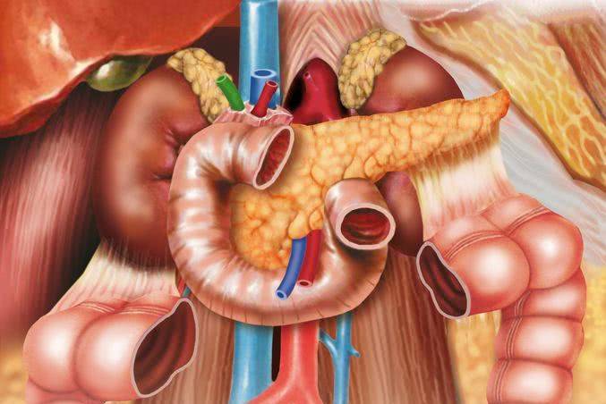 急性胰腺炎来得比较快,症状也比较明显,常见症状有这五个