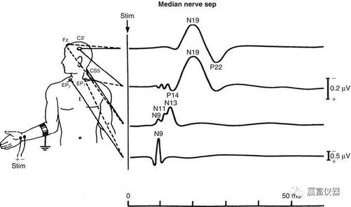 体感诱发电位 按潜伏期分类