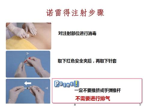 诺雷得的注射.ppt
