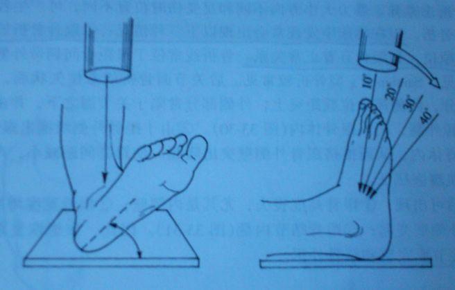骨科基础 | 跟骨骨折手术治疗的要点及技巧