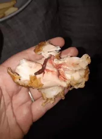 肯德基麦当劳又出事澳洲妹子吃炸鸡3个月仍在吐吃之前一定要看仔细