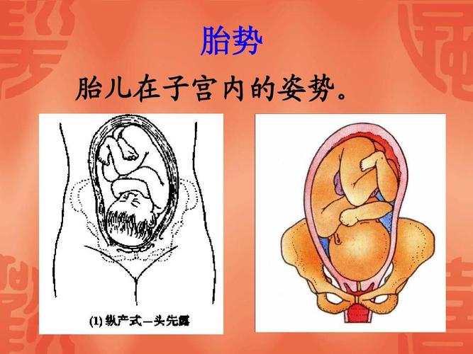 胎势 胎儿在子宫内的姿势.