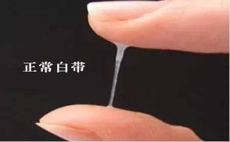 乳凝状或豆渣样白带 灰白色匀质鱼腥味白带 脓样白带 血性白带 水样