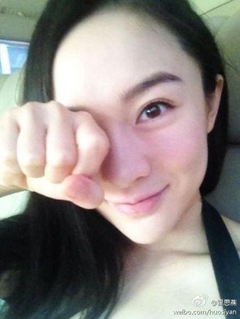 霍思燕晒胎儿b超照 说说四维彩超那些事