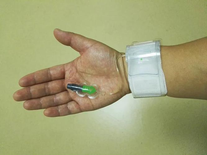 造影结束后,会在手臂穿刺处用专业的动脉止血器加压包扎.