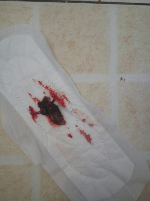 药流一个多月了,这俩天喝益母草跟消炎药