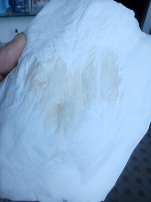 刚才出去走走回来内裤上有白带这样