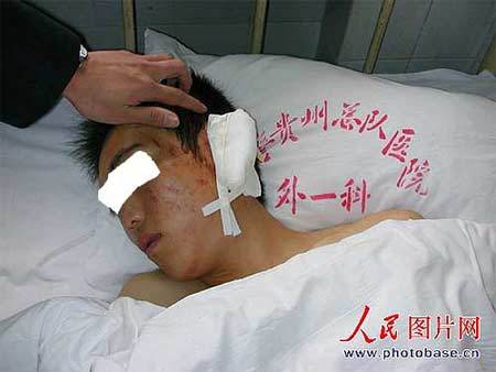 贵阳学院连续发生群殴事件20名学生受伤(组图)