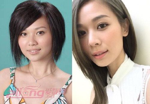 【香港tvb整容女星大起底】她们亲身上演了一场变脸记