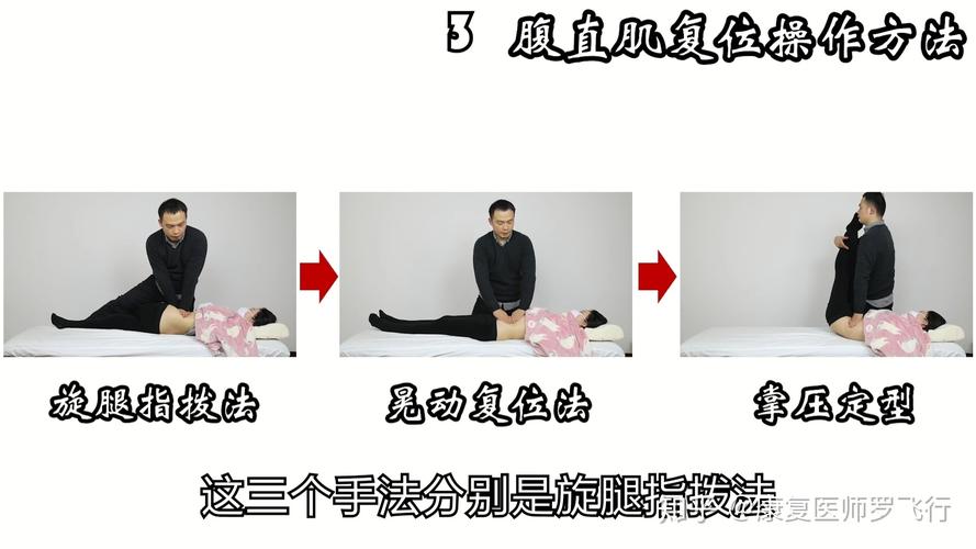 腹直肌分离,产后女性的小尴尬