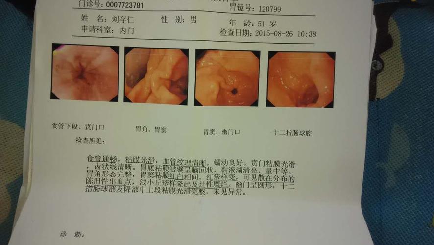 病情描述胃窦黏膜红白相间红疹样变可见散在分布的陈旧性出