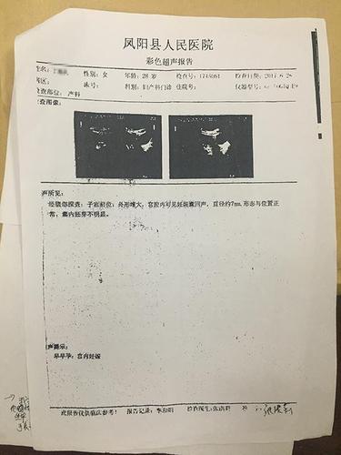 女子用ps伪造b超单 谎称警方执法致其流产被刑拘
