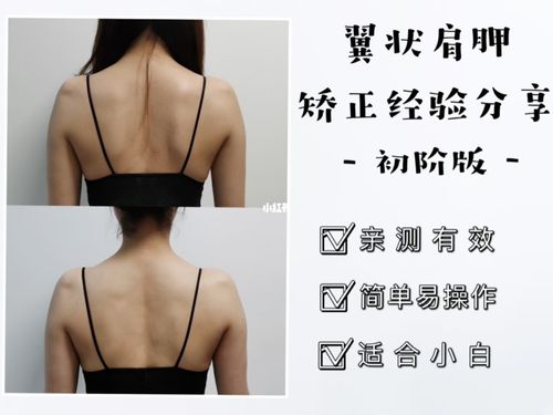 体态矫正 | 亲测有效的翼状肩胛矫正教程_收腹_体态矫正_运动健身