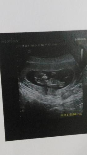 小猴子妈妈 宝宝12天lv.10  2016-01-19 11:36  淘气猴 宝宝12天lv.