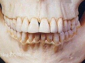 【牙齿分类及牙位记录】(图片)