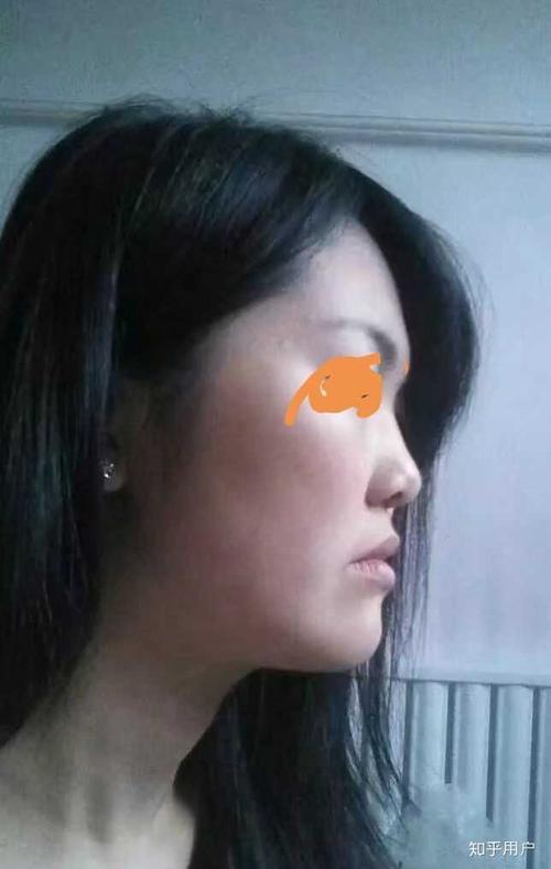 月亮脸?鞋拔子脸?是不是很丑?