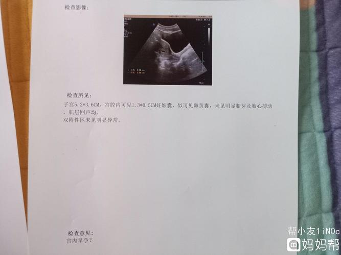 图一是42天做的彩超,图二是五十天做的彩