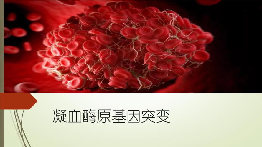凝血酶原基因突变.pptx