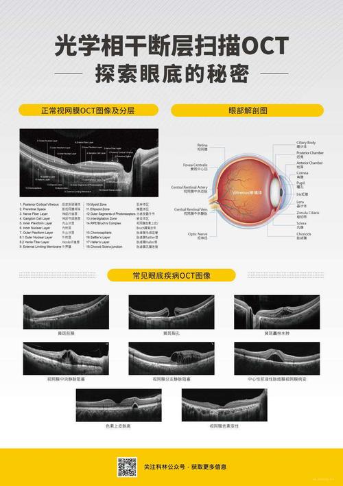 我院眼科oct正式投入使用! 写美篇 适应人群: 1.中老年人 2.