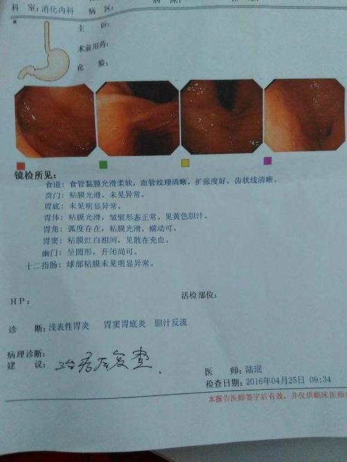 引发胃溃疡的病理性原因分析
