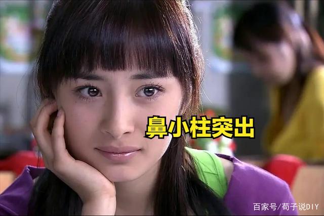 所以杨幂其实第一个动的是她的鼻子,切出了部分的鼻小柱,这样中庭就