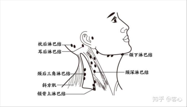 简单操作:可以用点穴的方式,刺激耳后淋巴结,促进毒素排出. 刮痧