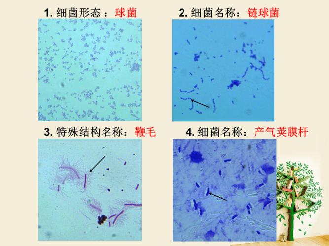 医学微生物学切片考试切片(完整版)